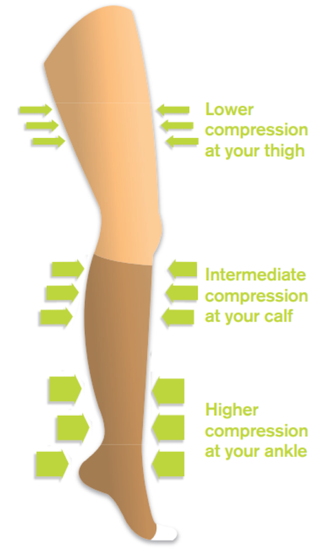 Altipress | Hosiery Kit for treating Venous Leg UlcersAltimed ...